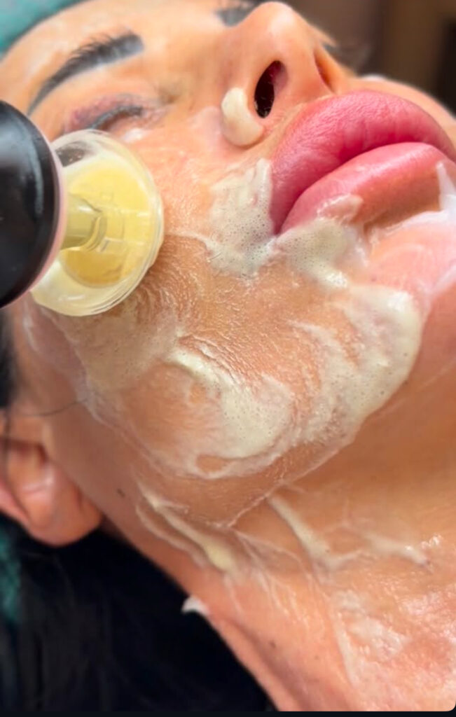 img 3695